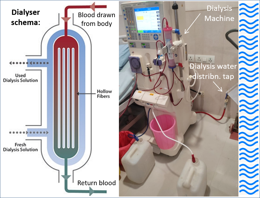 Image to illustrate DLB concept